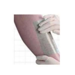 Aposito Secundario de Sujecion Flexigrid Opsite Allevyn Transparente y Adhesivo 12 X 25 Cm