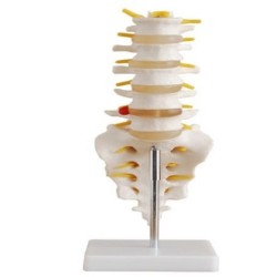 Juego de 5 Vertebras Tamaño Real con Sacro, Coxis y Hernia Discal