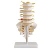 Juego de 5 Vertebras Tamaño Real con Sacro, Coxis y Hernia Discal