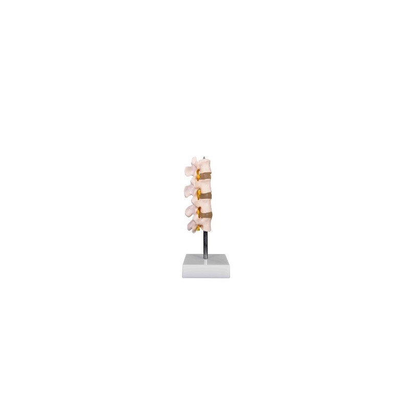 Set Lumbar en 4 Piezas